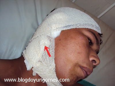 Lavrador tem parte da orelha decepada durante briga