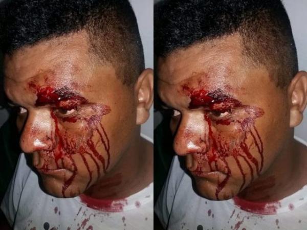 Radialista sofre tentativa de homicídio em Cabeceiras