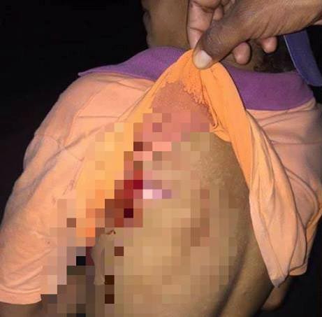 Homem denuncia sequestro após ser baleado na rodovia BR 020 em Picos