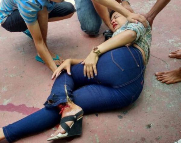 Acidente deixa vítima com fratura exposta em Floriano