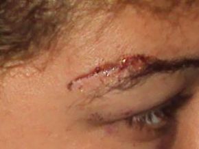 Mulher denuncia marido por agressão doméstica