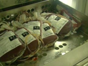 Baixo estoque de sangue faz HUT realizar apenas cirurgias de urgência