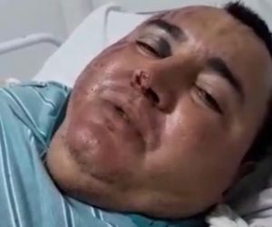 Cadeirante cai de plataforma e fratura cotovelo em Teresina