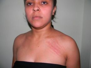 Professora denuncia motorista de prefeito do interior por agressão