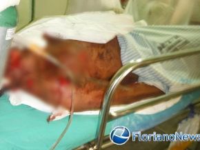 PM registrou tentativa de homicídio passional em Floriano