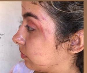 Blogueira é agredida por três mulheres ao sair de festa; Polícia investiga