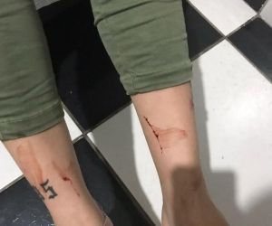 Jovem denuncia agressões de ex em rede social e incentiva outras mulheres no Piauí