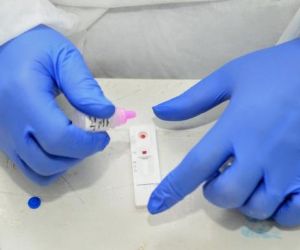 Piauí registra 473 casos confirmados e quatro óbitos por Covid-19 nas últimas 24 horas