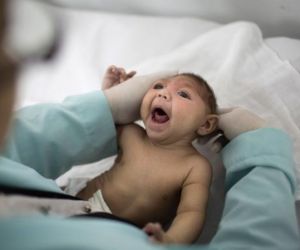 Estudo relaciona água contaminada a casos de microcefalia