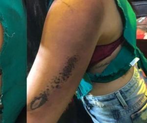 Mulher sofre queimaduras durante show pirotécnico em boate na Zona Leste de Teresina