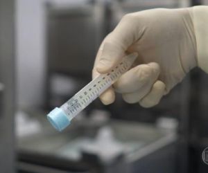 Piauí registra 402 casos confirmados e sete óbitos por Covid-19 nas últimas 24 horas