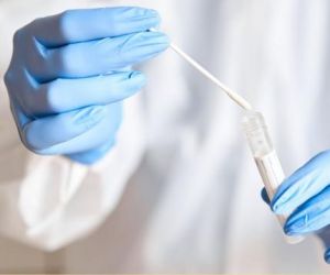 Piauí registra 162 casos confirmados e quatro óbitos por Covid-19 nas últimas 24 horas