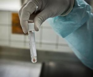 Piauí registra 118 casos confirmados e três óbitos de Covid-19 nas últimas 24 horas