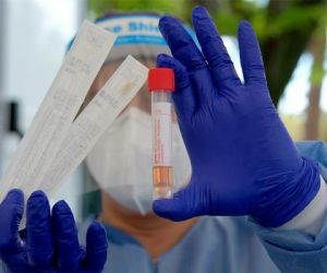 Fiocruz Amazônia cria teste rápido de detecção das novas variantes do coronavírus