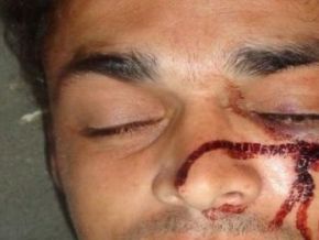 Homem é preso após tentar assaltar motel e acabar levando surra