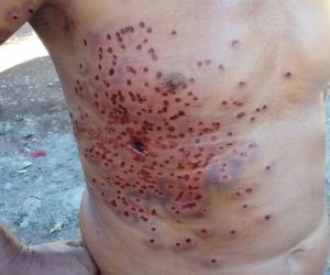 Homem sofre tentativa de homicídio com golpes de faca em Floriano