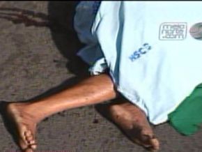 Idoso é colhido por caçamba e morre com cabeça 'esmagada'