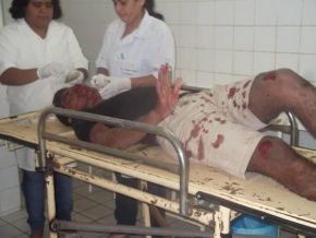 Jovem é levado para o HUT após acidente violento no centro de José de Freitas
