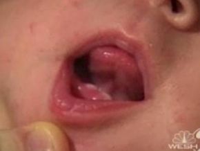 Bebê nasce com 2 dentes e surpreende mãe
