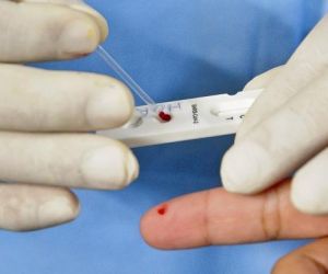 Piauí registra um óbito e 259 casos confirmados por Covid-19 nas últimas 24 horas