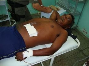 FLORIANO: Mulher fere o marido com faca durante briga.