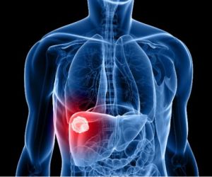 Em 1 ano, Piauí registra 240 novos casos de hepatite