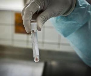 Piauí registra 52 novos casos e quatro óbitos por Covid-19 em 24 horas