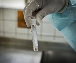 Piauí registra 42 casos confirmados e um óbito por Covid-19 nas últimas 24 horas