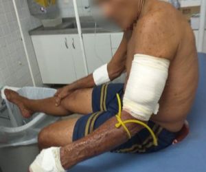 Idoso é esfaqueado pelo enteado na zona norte de Teresina
