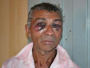 Lavrador é espancado ao pedir comida na casa de seus vizinhos