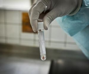 Piauí registra 433 casos confirmados e três óbitos de Covid-19 nas últimas 24 horas