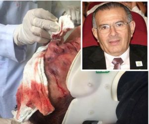 Valdeci Cavalcante permanece em hospital, mas está fora de perigo