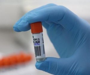 Piauí registra mais 410 novos casos e 10 mortes pela Covid-19 nas últimas 24 horas