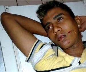 Jovem é preso em J. Freitas com moto rouba após sofrer acidente fugindo da polícia