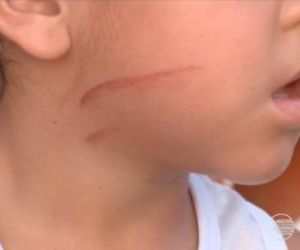 Ventilador de teto despenca em creche de Teresina e atinge quatro crianças