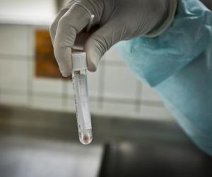 Piauí registra uma morte por Covid-19 e 56 novos casos em 24 horas