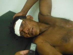 Homem é agredido e tem moto roubada em Floriano