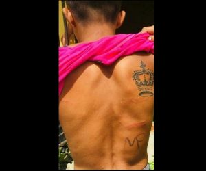 Mãe é presa após queimar o filho com ferro quente no Maranhão