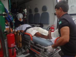 Acidente entre carro e moto deixa homem com fratura exposta no Centro de Floriano