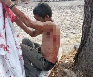 Deficiente mental é esfaqueado por mulher em Parnaíba