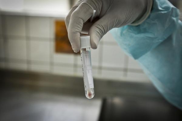 Piauí registra 118 novos casos nas últimas 24 horas e chega a 366.532 notificações