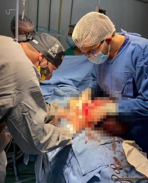 M&eacute;dicos retiram tumores pesando quase 11 kg de paciente idosa em Floriano.(Imagem:Hospital Tib&eacute;rio Nunes)