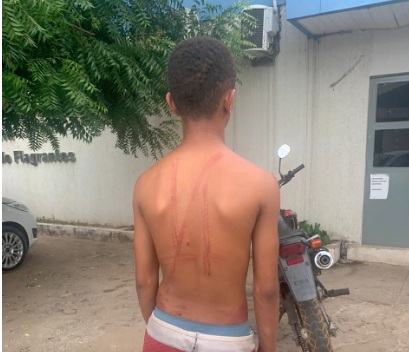 Adolescente suspeito de furtar esporas é punido com chicoteadas em cidade do Piauí