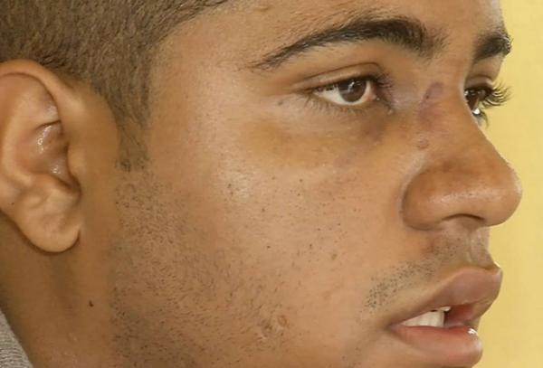 Jovem espancado diz ter sido alvo de racismo por usar tênis caro