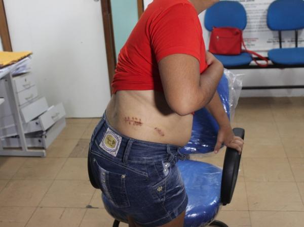 Mulher denuncia ex por tentar matá-la: 'me obrigava a usar e vender drogas'