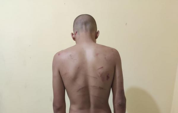 Homem é preso em flagrante suspeito de torturar e agredir namorado adolescente no PI