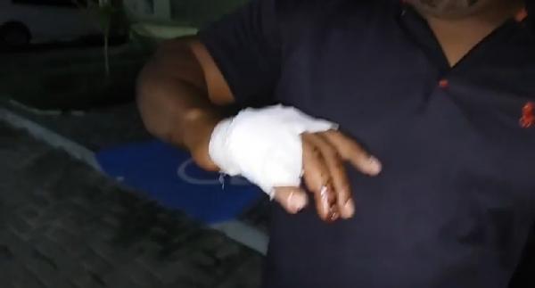 Ivanildo foi lesionado durante a discuss&atilde;o(Imagem:Reprodu&ccedil;&atilde;o/JC24horas)