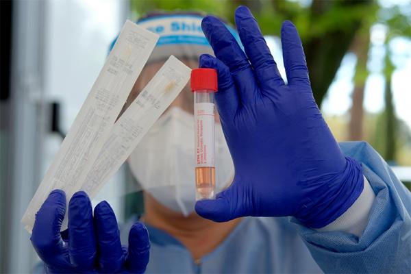 Piauí registrou média de 499 casos confirmados de covid-19 em dezembro