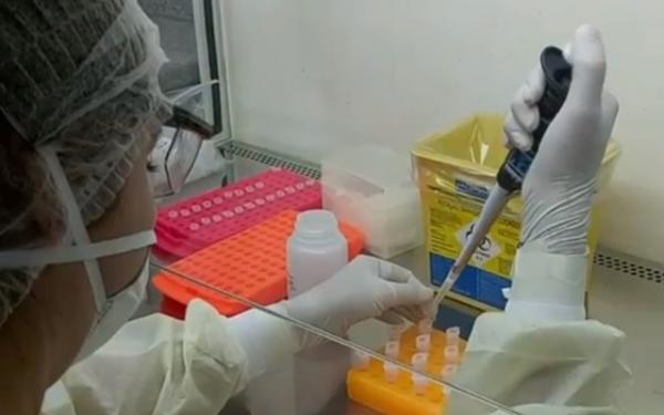 Número de casos confirmados de coronavírus sobe para 40 no Piauí; sete óbitos são registrados