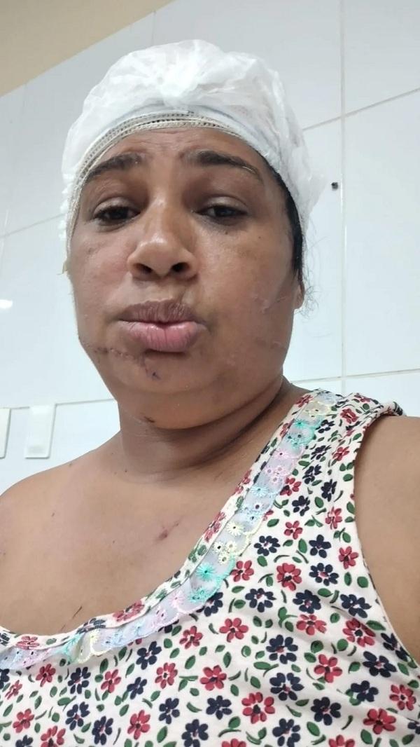  Guilhermina internada em hospital ap&oacute;s a tentativa de feminic&iacute;dio.(Imagem:Arquivo Pessoal )